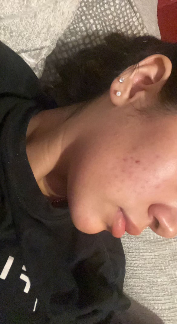 After treatment