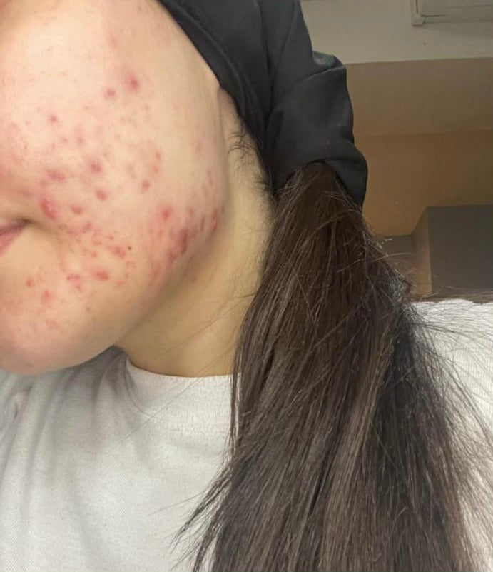 Before treatment