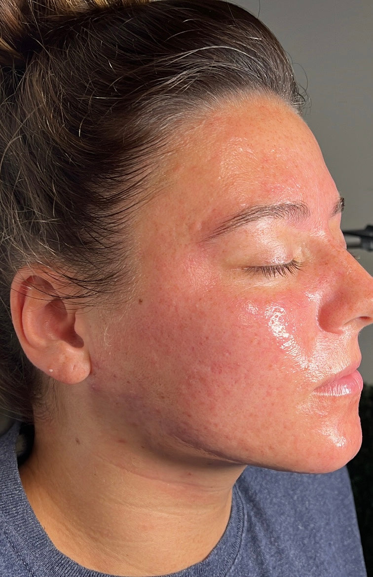 After treatment
