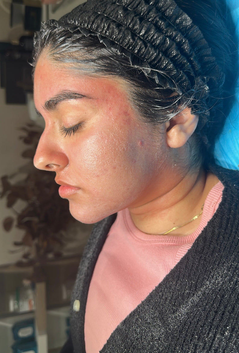 After treatment