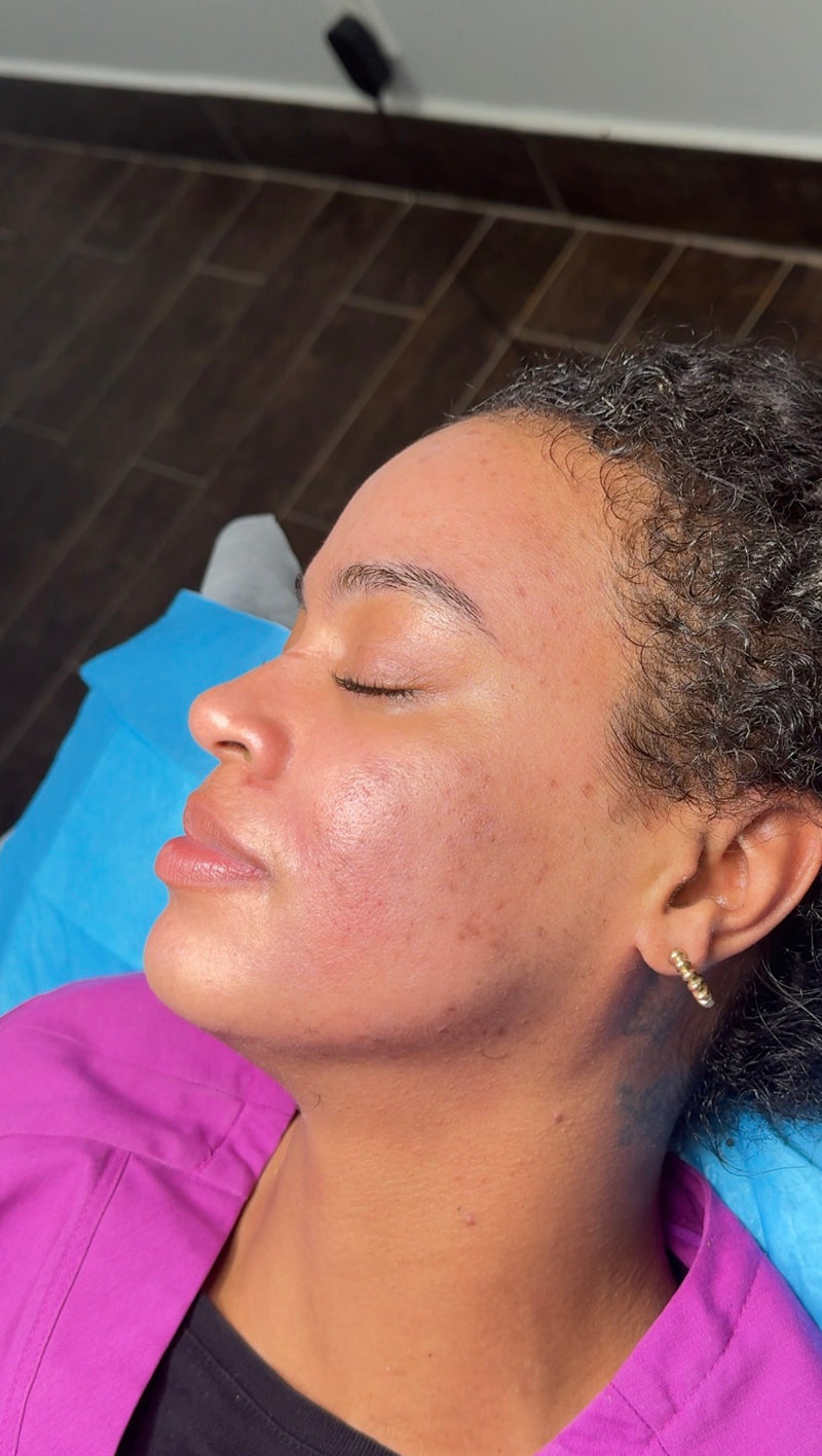 After treatment