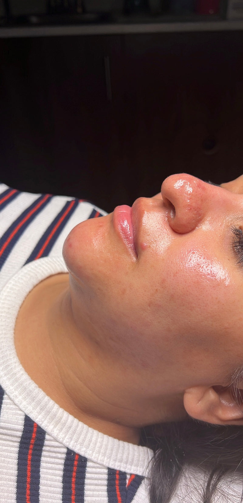 After treatment